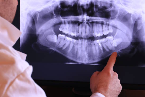 Best Emergency Dental Care for Sports Injuries in Cecil Bishop, PA